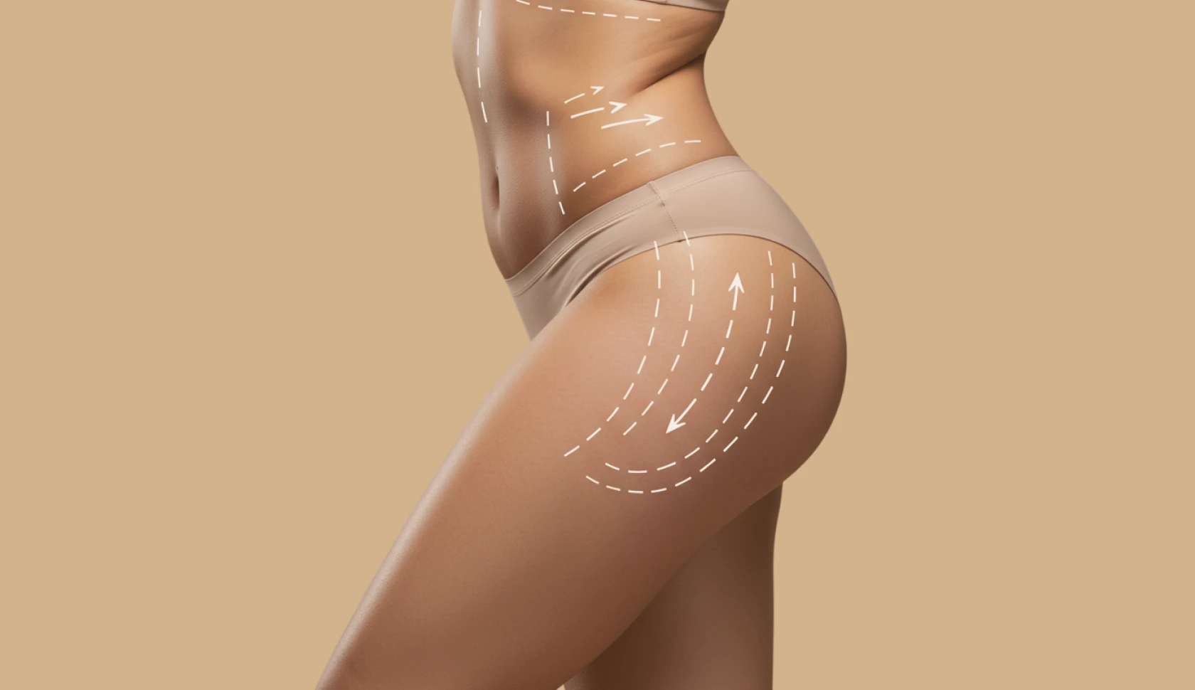 Culote em João Pessoa com a Dra. Ana Pontes.